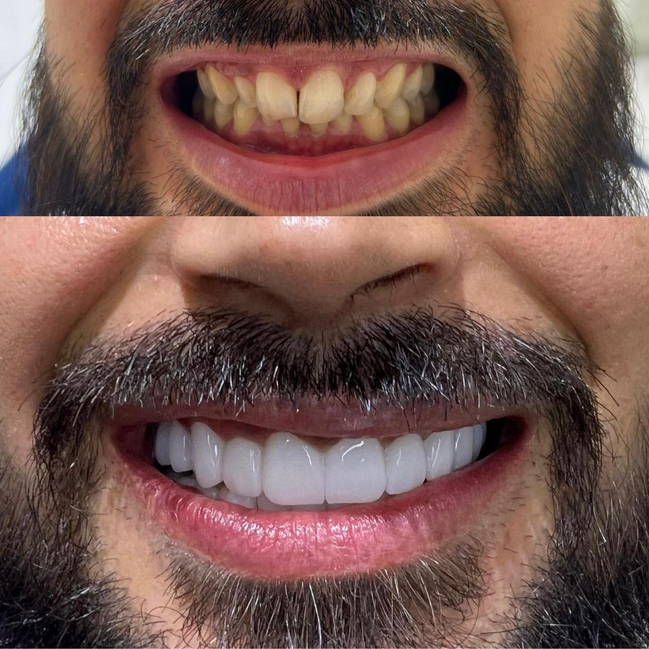 Prima e dopo caso 1